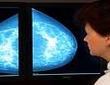 mammography